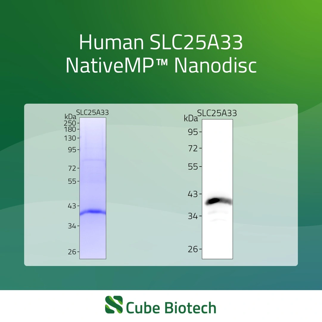 SLC25A33 - Solute carrier family 25 member 33